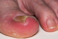 A toe, a tooth, and the theology of perspective