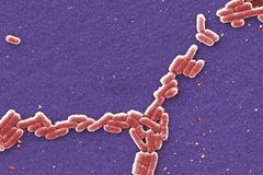 FBI charges Chinese researcher for E. coli smuggling