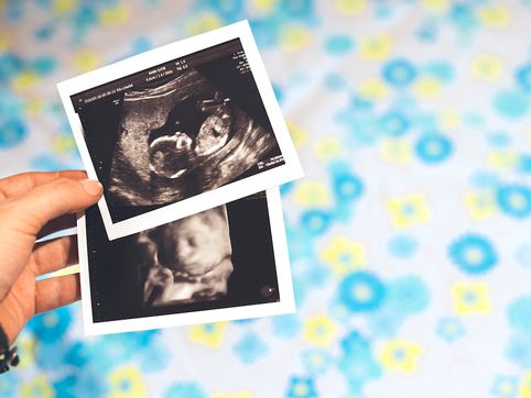 'Landmark achievement': New Puerto Rico law recognizes unborn children as people from conception