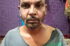 Muslim in Pakistan sets Christian on fire over petty dispute