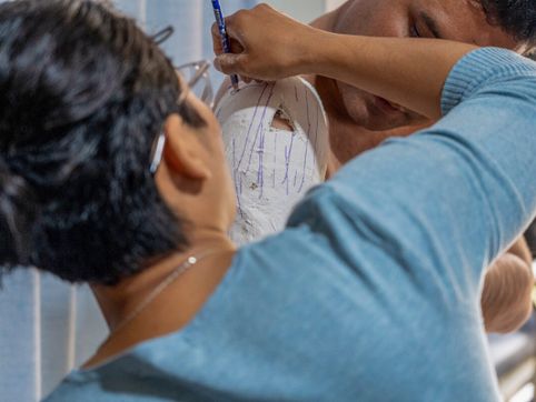 Prosthetics ministry opens gospel doors in East Asia | Baptist Press