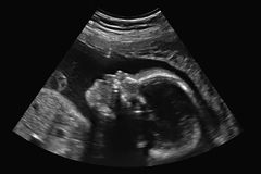 ERLC’s Psalm 139 Project places 100th ultrasound machine | Baptist Press