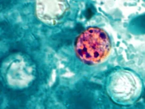 Michigan outbreak of parasitic infection sickens more than 1,200