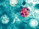Michigan outbreak of parasitic infection sickens more than 1,200