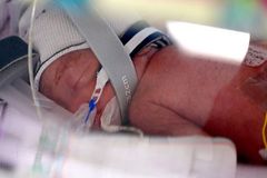 Rare set of identical quadruplet girls born in Australia