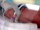 Rare set of identical quadruplet girls born in Australia
