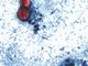 FDA investigating new group of diarrhea parasite cases