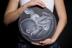 My parents adopted 20 embryos. I was the only one to survive.