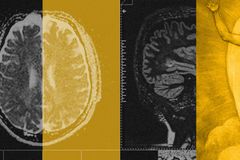 Studying Pain ‘Causes Me to Pine for Eternity’
