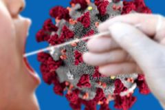 오미크론 우세지역, 앞으론 고위험군만 PCR검사