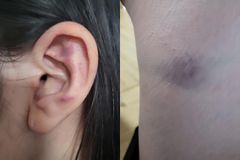 모텔서 옷 벗겨 4시간 폭행…영상통화한 10대 여학생들