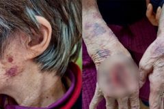 ‘치매 노인 폭행’ 김천 노인보호센터 종사자 7명 과태료 처분