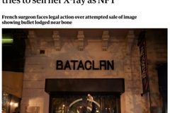 ‘파리테러’ 생존자 엑스레이로 NFT를…佛의사 발상에 비난