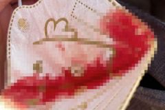 “아야” PCR 검사 5살, 마스크에 피 흥건…“업무 과중 탓”