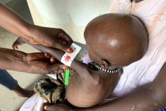 동아프리카, 가뭄과 우크라 밀 수입 중단으로 최악의 식량난