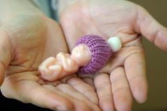 “세포라 생각했던 12주 태아, 눈·코·입 다 있네요”