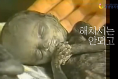기공협, 국회에 낙태죄 관련 모자보건법 개정 촉구