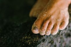 [백석균의 건강칼럼] 발가락 변형으로 발가락 신경이 둔해지면 온몸이 망가진다