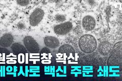 “언론들 원숭이두창에 침묵, 인권보도준칙 때문인가?”