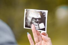 “낙태 금지는 여자에게 좋은 일이다”