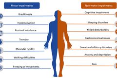 [뇌치유상담] 노년기의 뇌, 퇴행성 뇌질환이 발생하는 시기이다(2)