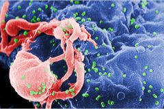 “동성 성접촉에 따른 HIV 감염인 2019년부터 75%대 증가”