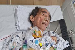 “간이식 기적 선물에, 수술비 지원 또 하나의 기적”