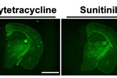 항생제 내성 사망자 2030년 3만 명 전망… 정부, 제3차 국가 항생제 내성 관리 대책 추진
