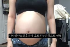 “36주 태아가 모체 밖에서 죽었는데… 산모 무죄 판결 규탄”