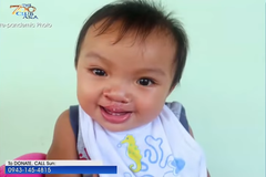 New Year, New Smile for Baby Jhorex