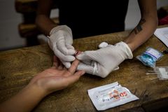 People living with HIV in Philippines to double by 2030, health official warns