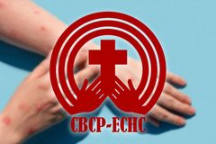 Mamamayan, binalaan ng CBCP-ECHC sa pagkalat hg fake news sa MPOX virus