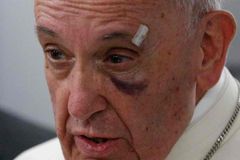Pope says he hopes Trump reconsiders DACA decision