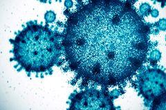 COVID-19 virus, hindi nawala sa Pilipinas - VeritasPH